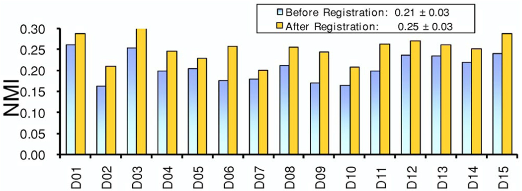 FIG. 11