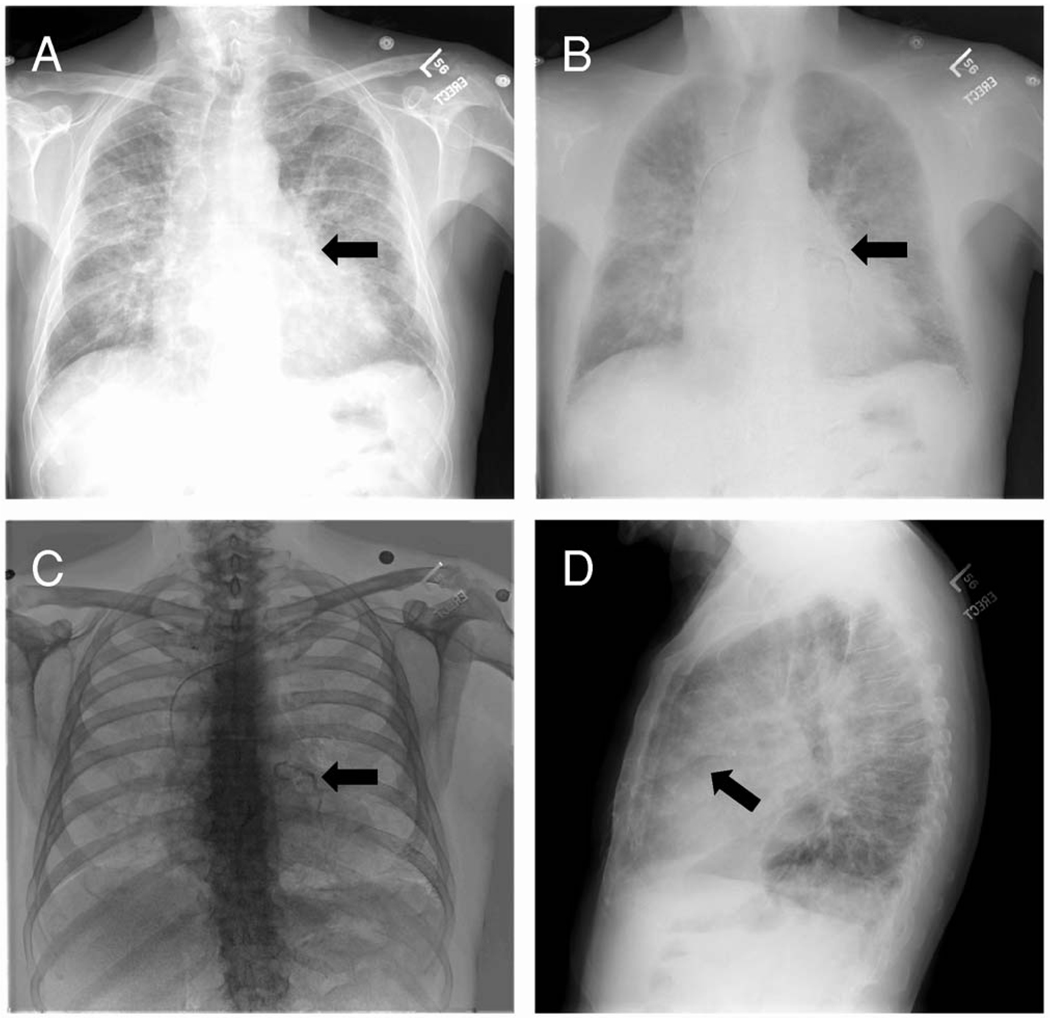 FIG. 1