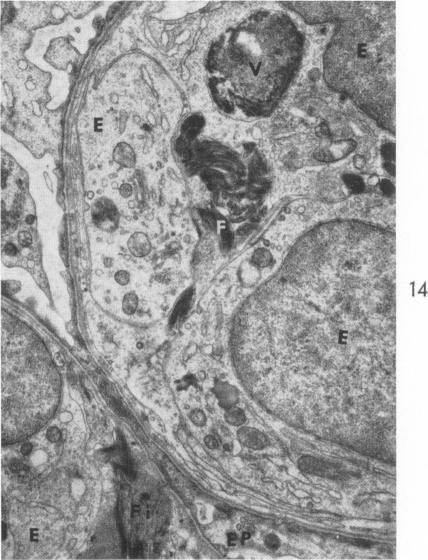 Fig. 14