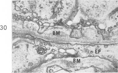 Fig. 30