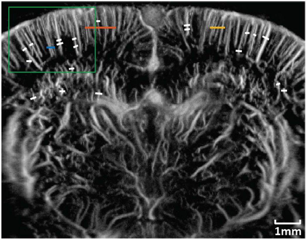 Fig. 14.