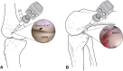 Fig. 2A–B