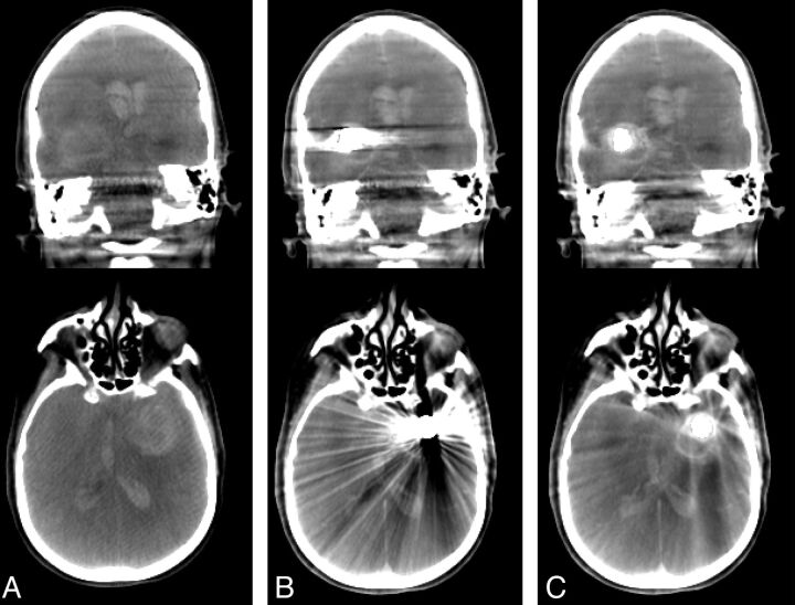 Fig 2.