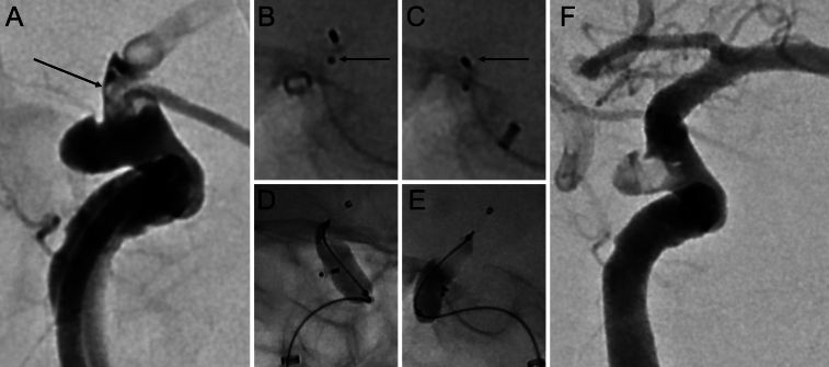 FIG. 2.