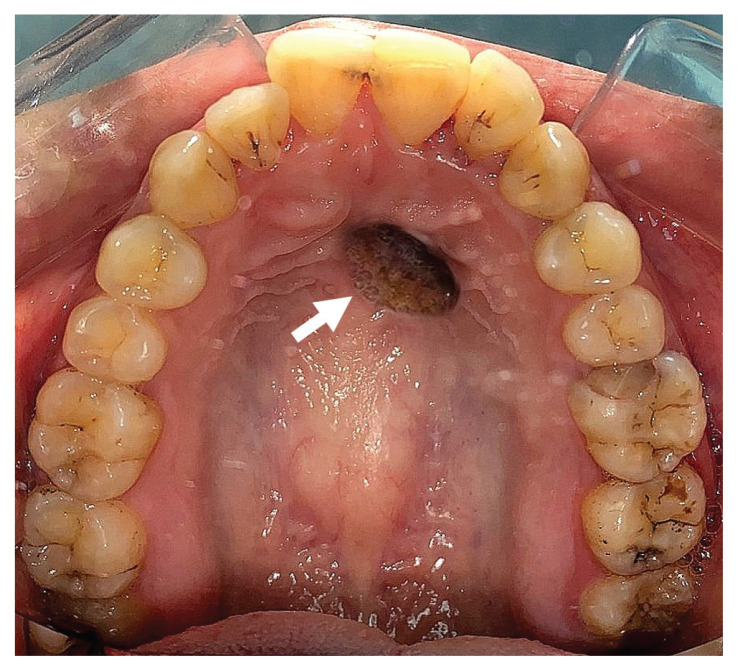 Figure 1: