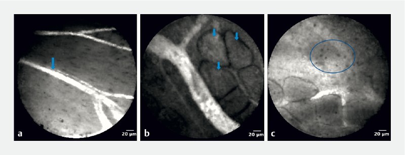 Fig. 3