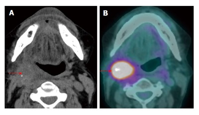 Figure 19