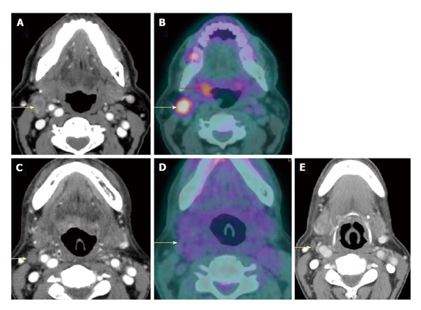 Figure 16