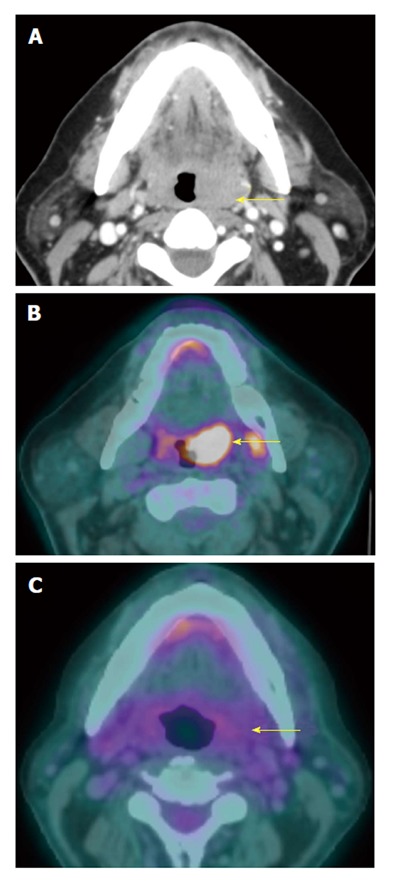 Figure 15