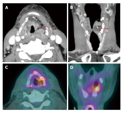 Figure 17