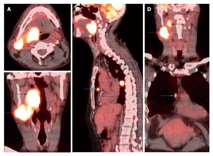 Figure 14