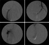 Fig 4
