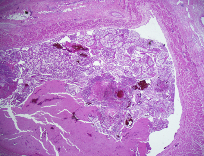 Fig. 3