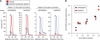 Figure 4. Targeted proteomics measurements of plasma ORF1p from large sample volumes. A, ORF1p measured from two gastric cancer patients using two quantotypic peptides (LSFISEGEIK and NLEECIR, red traces) with internal isotopically labeled standards (blue traces); a high-ORF1p cancer patient [1,231 pg/mL by Simoa, 3.5 mL plasma used for immunoprecipitation (IP)] and high-ORF1p healthy patient (3.0 pg/mL by Simoa, 5 mL plasma used for IP) are shown with 900 amol standard injected. B, Correlation between measured ORF1p by Simoa and targeted proteomics assays; r = 0.97 (Simoa vs. LSFISEGEIK) and r = 0.99 (Simoa vs. NLEECIR, t test), P < 0.0001 for both.