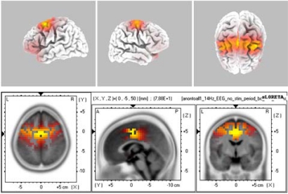 Fig. (4)