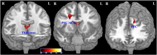 Fig. 4