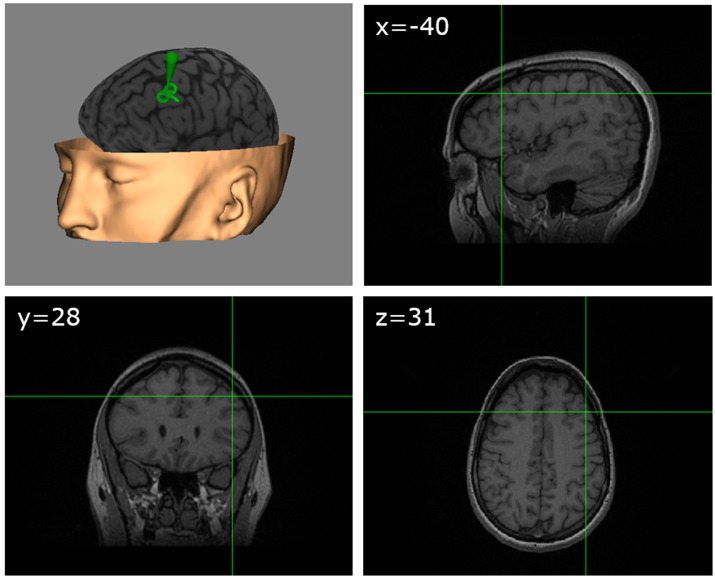 Figure 2