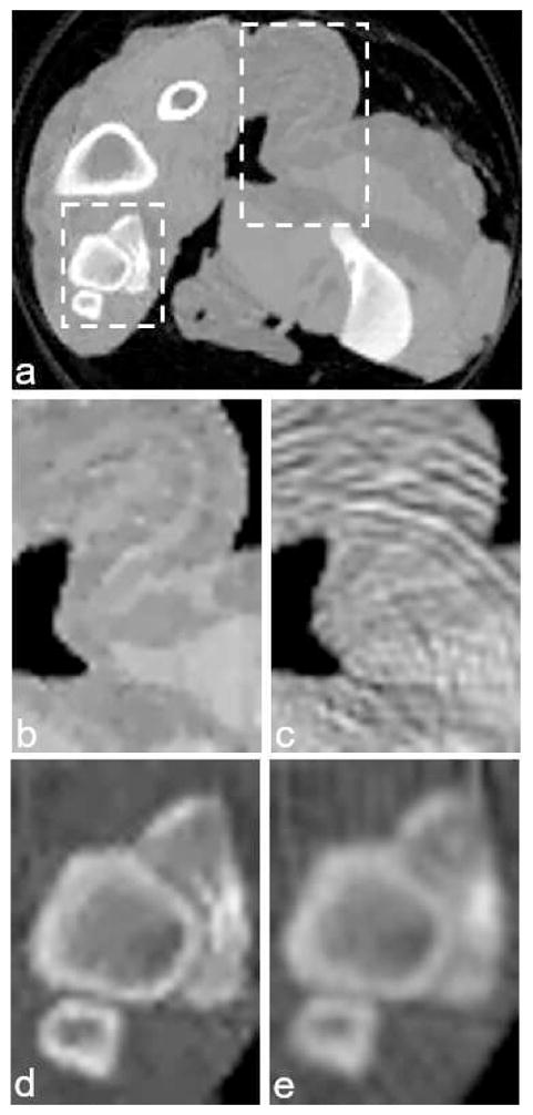 Fig. 12