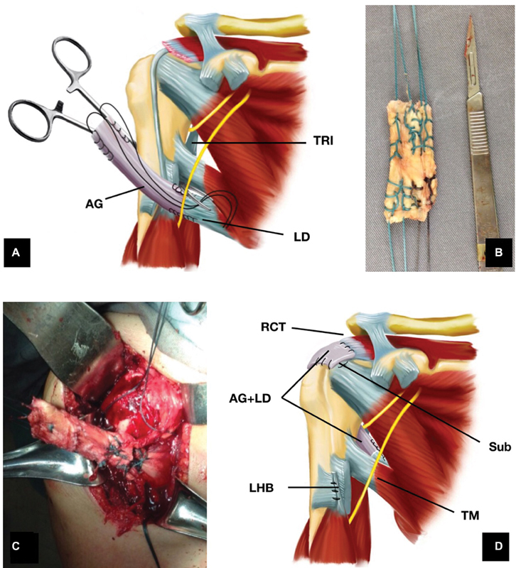 Fig. 4