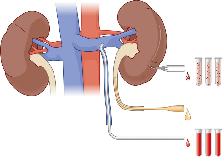 FIGURE 3