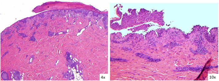 Fig 3