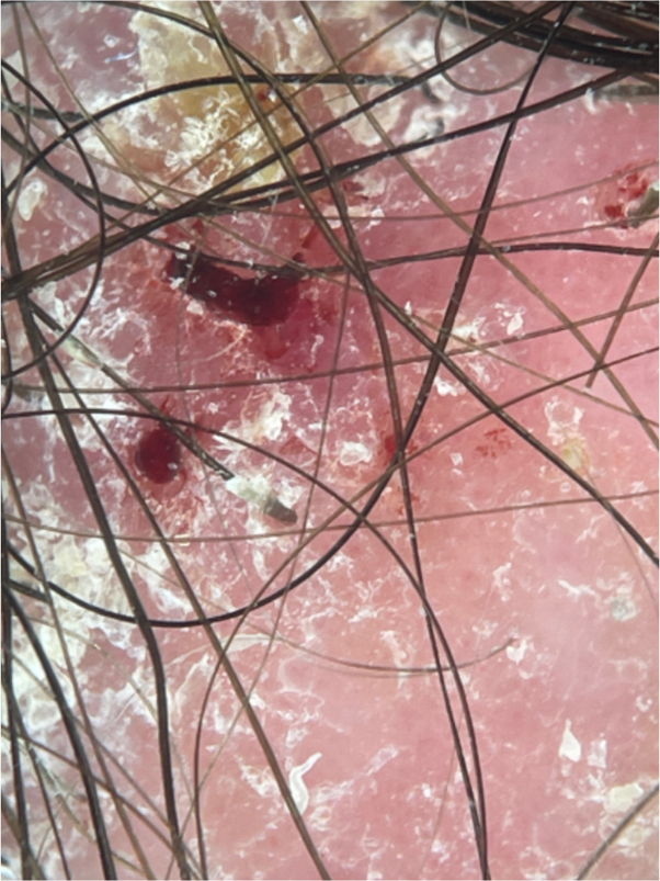 Fig 2