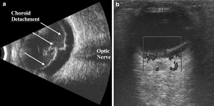 Fig. 14