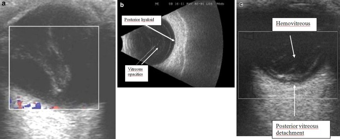 Fig. 16