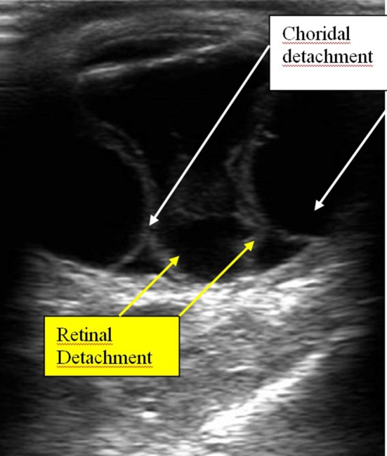 Fig. 15