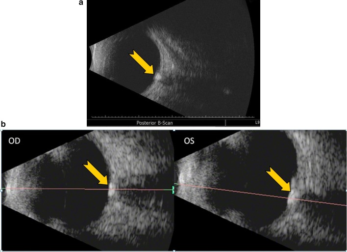 Fig. 9