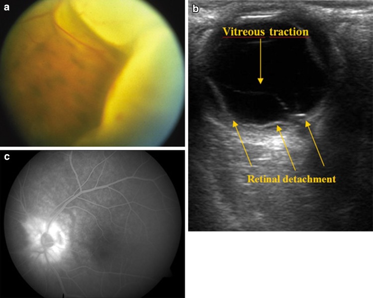 Fig. 11