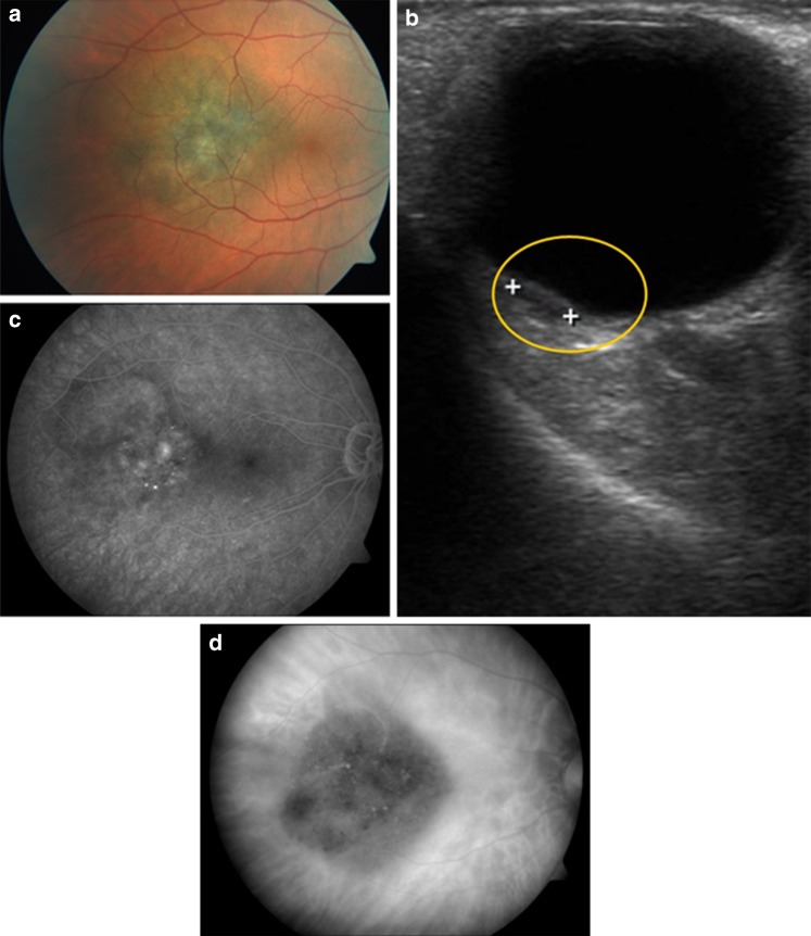 Fig. 6