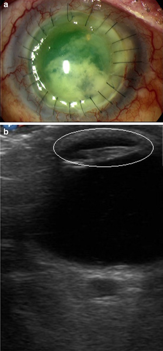 Fig. 4