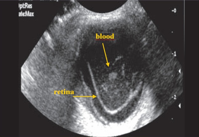 Fig. 5