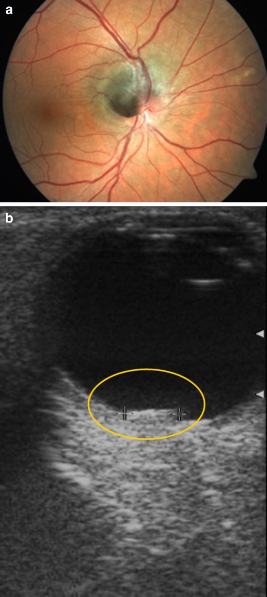 Fig. 8