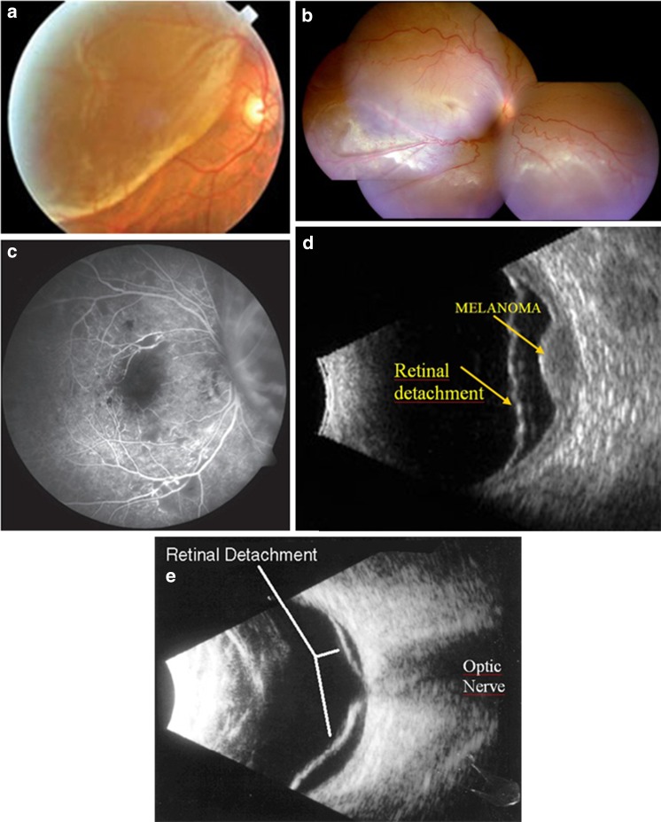 Fig. 13