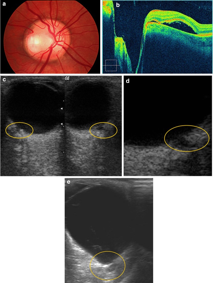 Fig. 10