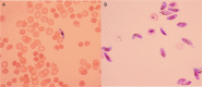 FIG 1