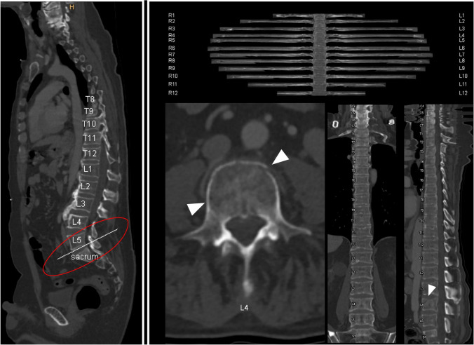 Fig. 2