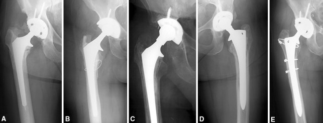 Fig. 2A–E