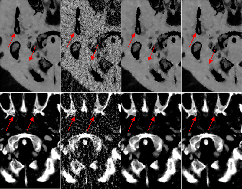 Fig. 16.