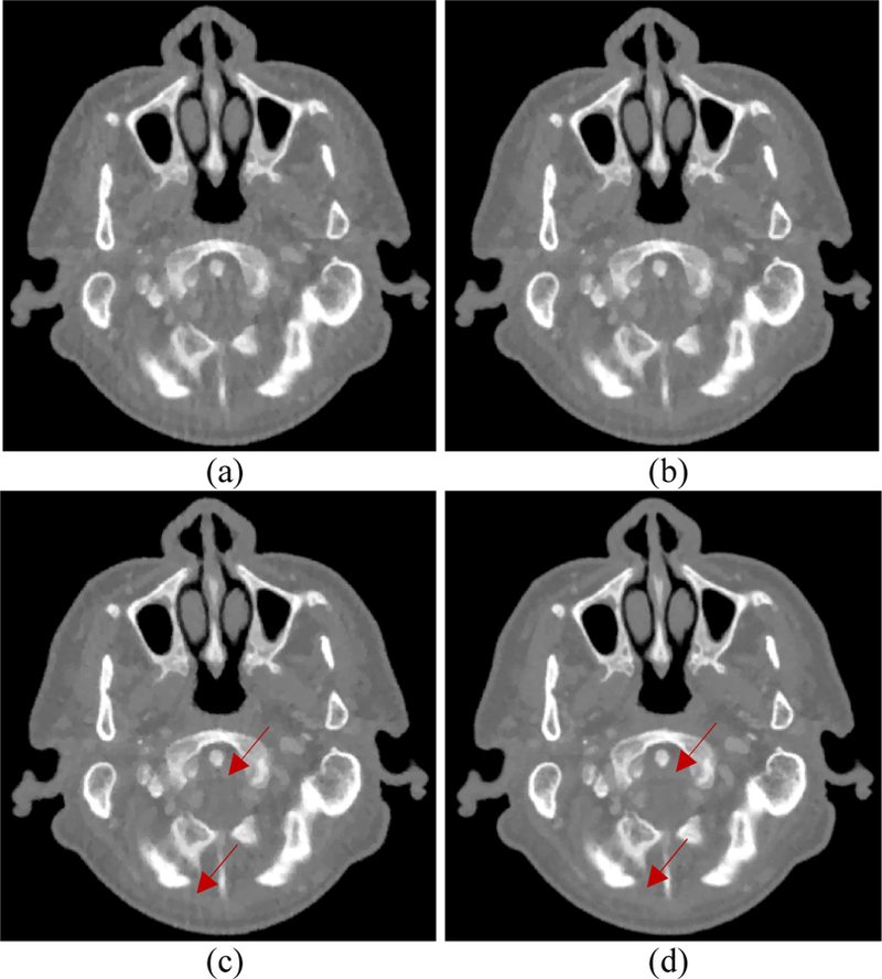 Fig. 26.