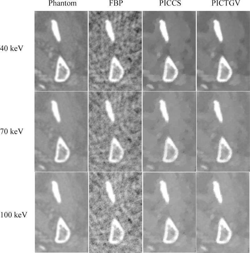 Fig. 12.