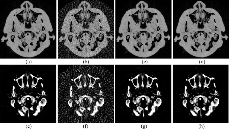 Fig. 15.