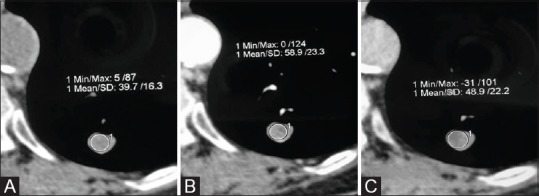 Figure 13 (A-C)