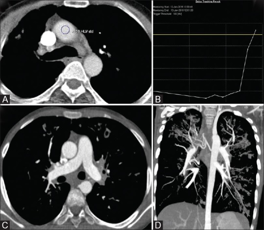 Figure 12 (A-D)