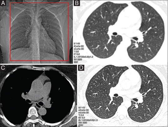 Figure 1 (A-D)