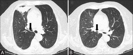 Figure 7 (A and B)