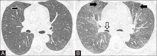 Figure 3 (A and B)