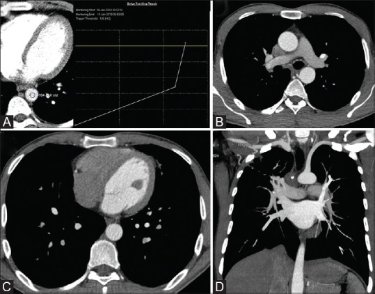 Figure 11 (A-D)